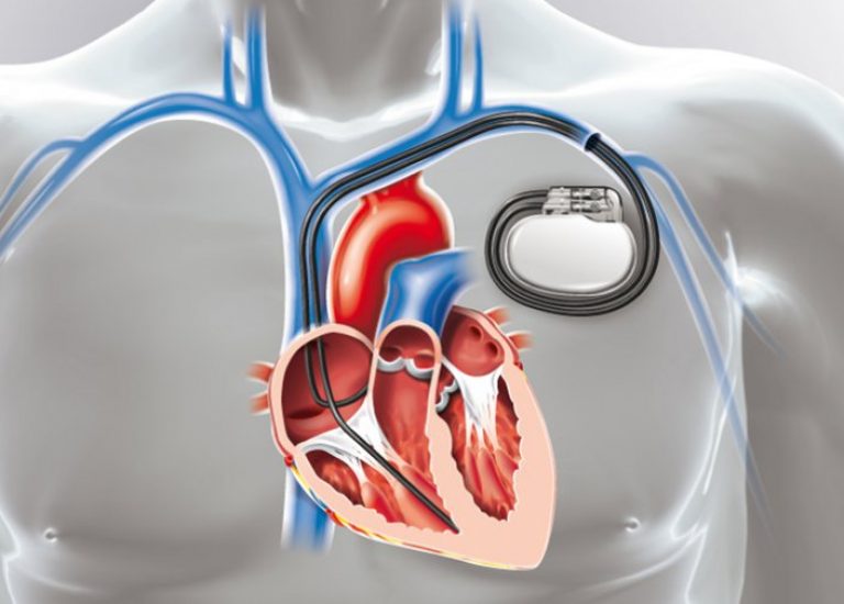 CARPacemaker CardiologieIntercard